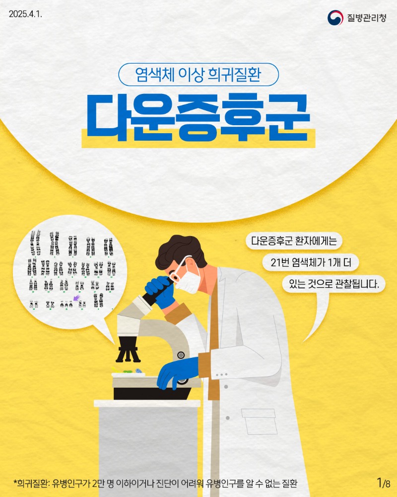 250401_다운증후군_1.jpg