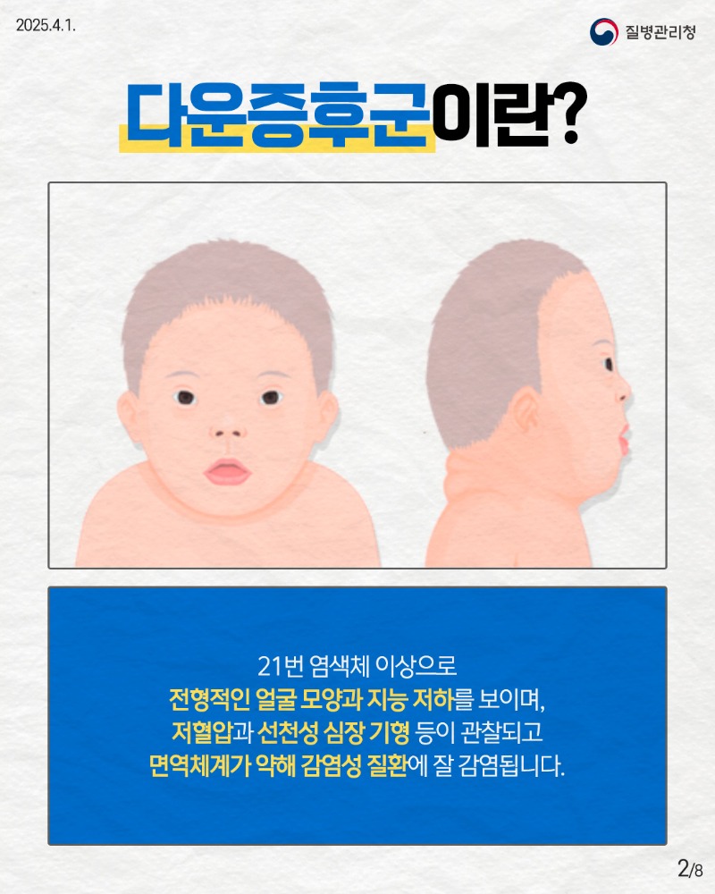 250401_다운증후군_2.jpg