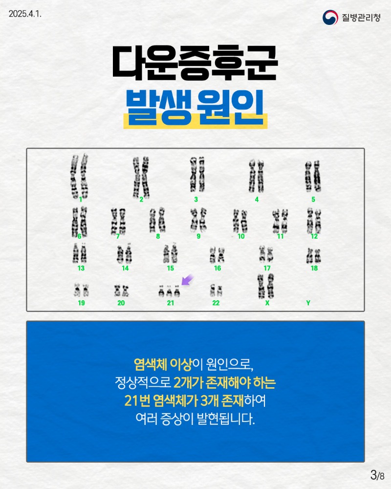 250401_다운증후군_3.jpg