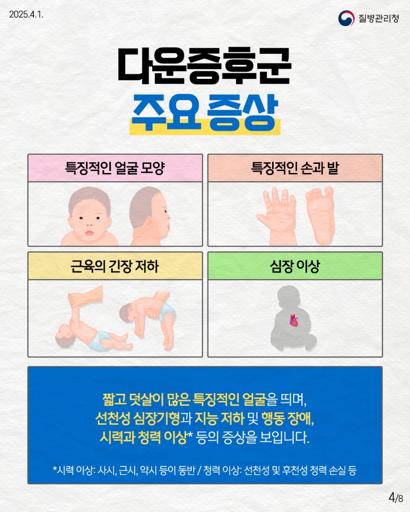 250401_다운증후군_4.jpg